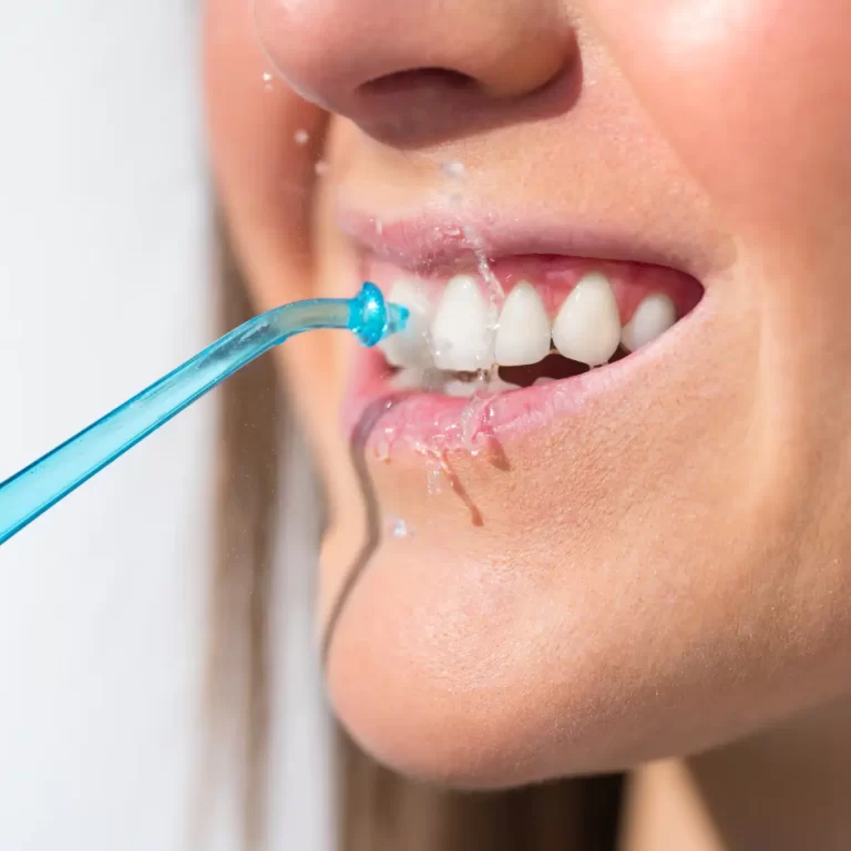 parodontológia (2)